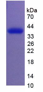 Recombinant Plasmalemma Vesicle Associated Protein (PLVAP)