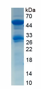 Recombinant Pyruvate Carboxylase (PC)