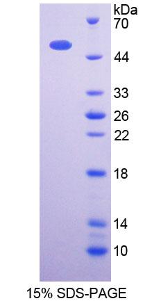 Recombinant 3-Oxoacid Coenzyme A Transferase 1 (OXCT1)