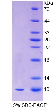 Recombinant Oncomodulin (OCM)