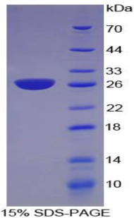 Recombinant Nicotinamide-N-Methyltransferase (NNMT)