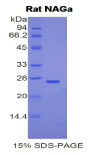 Recombinant N-Acetylgalactosaminidase Alpha (NAGa)