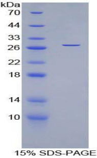 Recombinant Myocilin (MYOC)