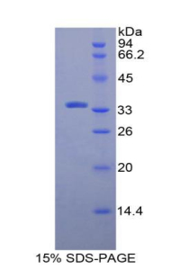 Recombinant N-Methylpurine DNA Glycosylase (MPG)