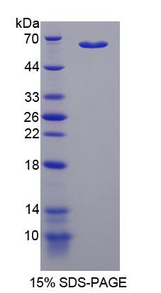 Recombinant Malate Dehydrogenase 1 (MDH1)