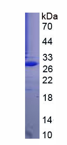 Recombinant Latexin (LXN)