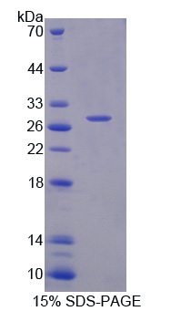 Recombinant Lymphocyte Adaptor Protein (Lnk)