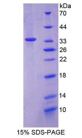 Recombinant Lectin, Mannose Binding 2 (LMAN2)