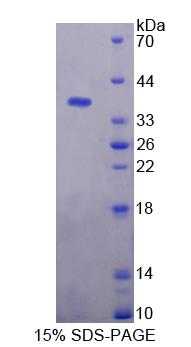 Recombinant Kynurenine-3-Monooxygenase (KMO)