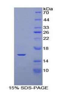 Recombinant Klotho Beta (KLb)