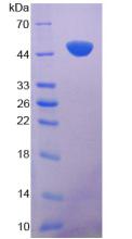 Recombinant Klotho (KL)