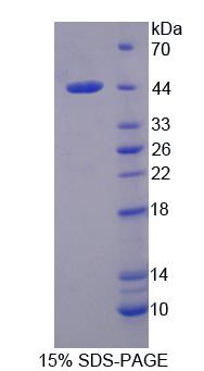 Recombinant Interleukin 1 Receptor Accessory Protein (IL1RAP)