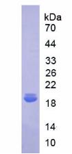 Recombinant Interleukin 18 Binding Protein (IL18BP)