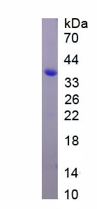 Recombinant Exosome Component 2 (EXOSC2)