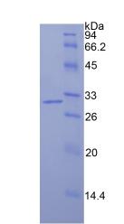 Recombinant Isocitrate Dehydrogenase 1, Soluble (IDH1)