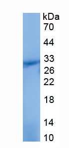 Recombinant Lymphatic Vessel Endothelial Hyaluronan Receptor 1 (LYVE1)