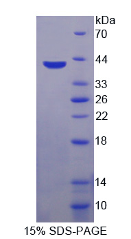 Recombinant Glycosylphosphatidylinositol Specific Phospholipase D1 (GPLD1)