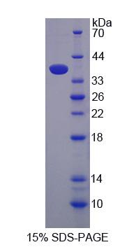 Recombinant Gamma-Glutamyl Hydrolase (gGH)