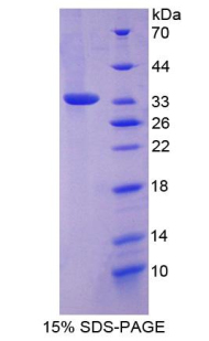 Recombinant FOS Like Antigen 1 (FOSL1)