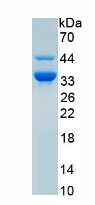 Recombinant Eosinophil Peroxidase (EPX)