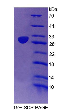 Recombinant Elastin Microfibril Interface Located Protein 2 (EMILIN2)