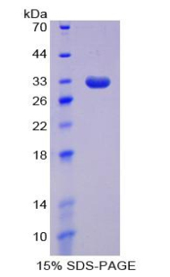 Recombinant DNA Methyltransferase 1 (DNMT1)