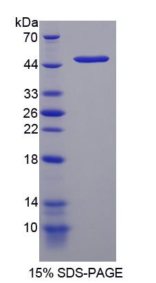 Recombinant DNA Damage Inducible Transcript 3 (DDIT3)