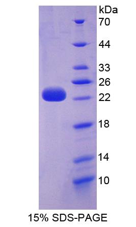 Recombinant D2-Hydroxyglutarate Dehydrogenase (D2HGDH)