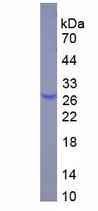 Recombinant Coxsackie Virus And Adenovirus Receptor (CXADR)