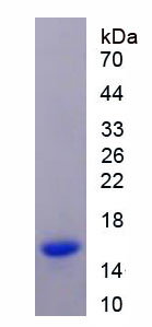 Recombinant Cystatin 1 (CST1)