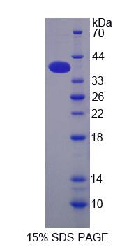 Recombinant Cleavage And Polyadenylation Specific Factor 1 (CPSF1)