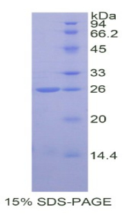 Recombinant Catechol-O-Methyltransferase (COMT)