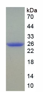 Recombinant Catechol-O-Methyltransferase (COMT)