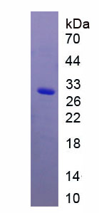 Recombinant Catechol-O-Methyltransferase (COMT)