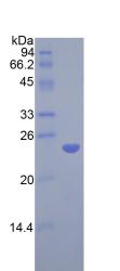 Recombinant Catechol-O-Methyltransferase (COMT)