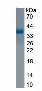 Recombinant Cystathionine Beta Synthase (CbS)