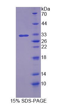 Recombinant BMP Binding Endothelial Regulator (BMPER)