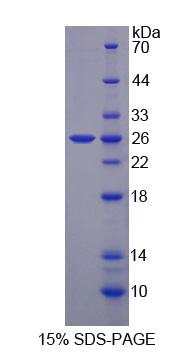 Recombinant Biliverdin Reductase B (BLVRB)