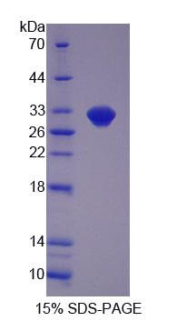 Recombinant Beta-1,4-N-Acetyl Galactosaminyl Transferase 2 (b4GALNT2)