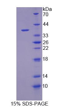 Recombinant Actin Related Protein 2/3 Complex Subunit 2 (ARPC2)