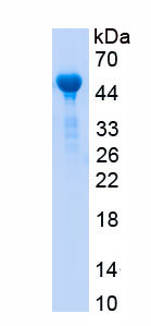 Recombinant Translocator Protein (TSPO)