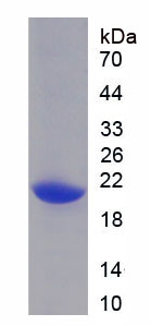 Recombinant Acidic Nuclear Phosphoprotein 32 Family, Member A (ANP32A)