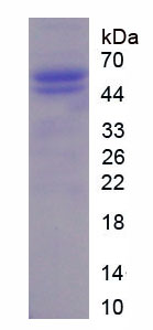 Recombinant Acidic Nuclear Phosphoprotein 32 Family, Member A (ANP32A)