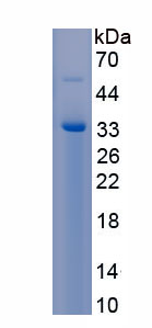 Recombinant Anillin (ANLN)