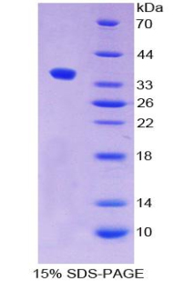 Recombinant Alkaline Phosphatase, Placental Like Protein 2 (ALPPL2)