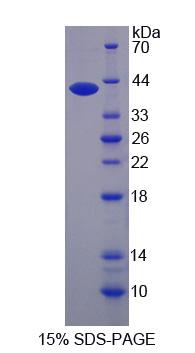 Recombinant Desmoyokin (AHNAK)