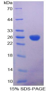 Recombinant Aconitase 1 (ACO1)