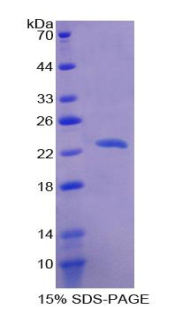 Recombinant Aconitase 1 (ACO1)