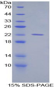 Recombinant Aconitase 1 (ACO1)