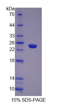 Recombinant Abl Interactor 1 (ABI1)